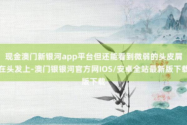 现金澳门新银河app平台但还能看到微弱的头皮屑在头发上-澳门银银河官方网IOS/安卓全站最新版下载